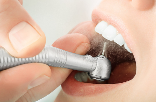 Bọc răng sứ có đau không - ảnh 2 Bọc răng sứ có đau không - ảnh 2