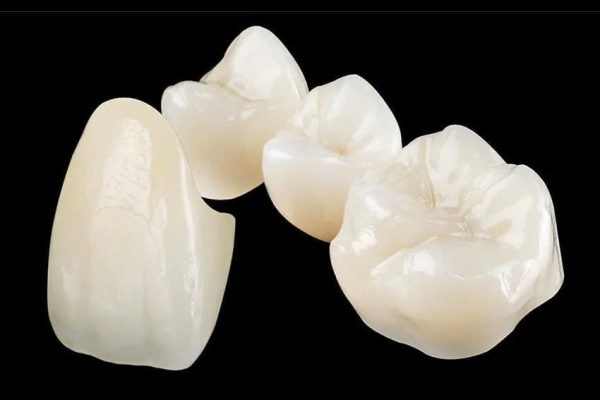 bọc răng sứ loại nào tốt - ảnh 1 bọc răng sứ loại nào tốt - ảnh 1