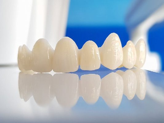 bọc răng sứ loại nào tốt - ảnh 4 bọc răng sứ loại nào tốt - ảnh 4