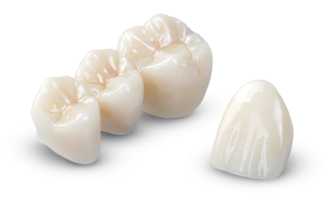 bọc răng sứ loại nào tốt - ảnh 8 bọc răng sứ loại nào tốt - ảnh 8