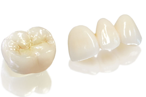 bọc răng sứ loại nào tốt - ảnh 9 bọc răng sứ loại nào tốt - ảnh 9