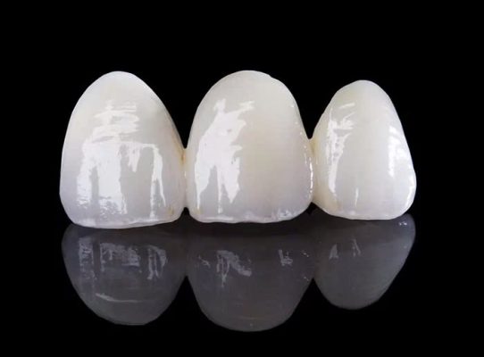bọc răng sứ toàn hàm - ảnh 3 bọc răng sứ toàn hàm - ảnh 3