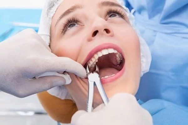 Nhổ răng có đau không? - ảnh 1 Nhổ răng có đau không? - ảnh 1
