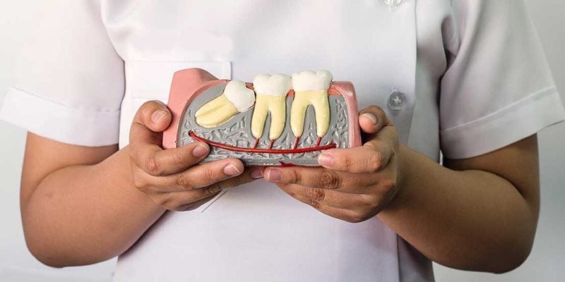 nhổ răng khôn - ảnh 5 nhổ răng khôn - ảnh 5