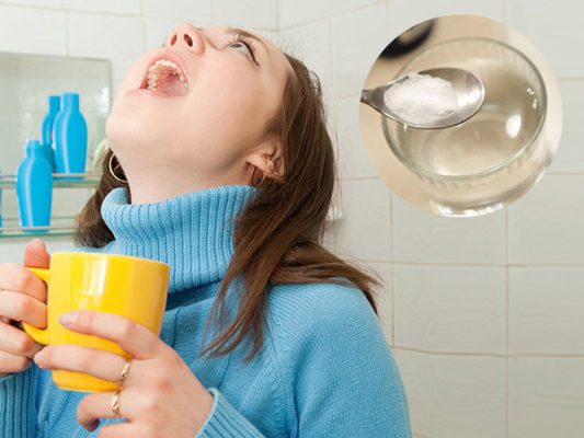 Niềng răng có đau không? - ảnh 8 Niềng răng có đau không? - ảnh 8