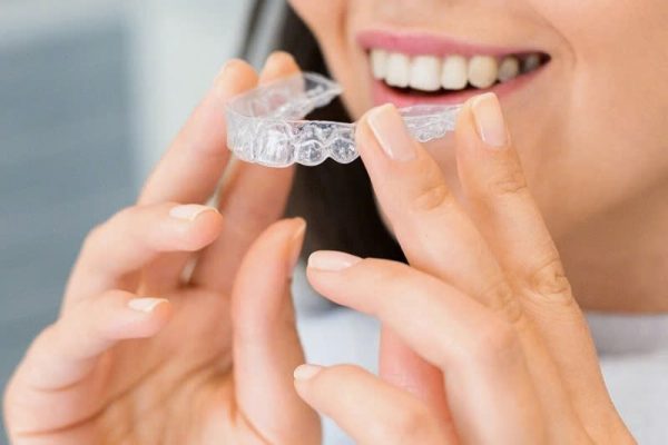 niềng răng lệch - ảnh 5 niềng răng lệch - ảnh 5