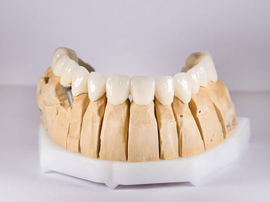 Răng sứ Ceramill - ảnh 1 Răng sứ Ceramill - ảnh 1