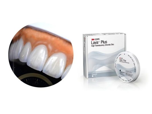 Răng sứ Lava Plus - ảnh 1 Răng sứ Lava Plus - ảnh 1