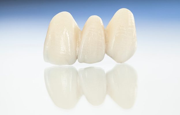 Răng sứ Nacera Q3 - ảnh 2 Răng sứ Nacera Q3 - ảnh 2