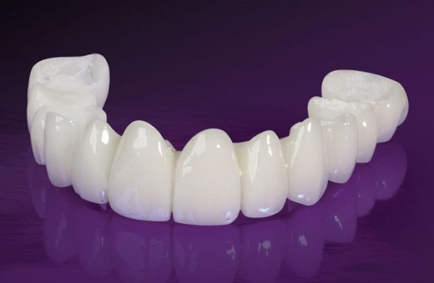 Răng sứ Nacera Q3 - ảnh 3 Răng sứ Nacera Q3 - ảnh 3