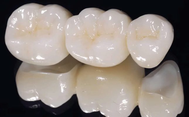 Răng sứ Zirconia - ảnh 2 Răng sứ Zirconia - ảnh 2