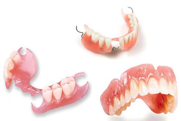 trồng răng có đau không - ảnh 1 trồng răng có đau không - ảnh 1