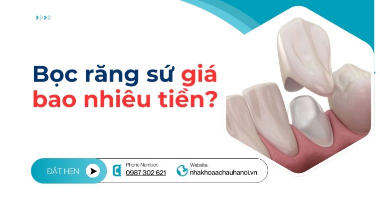 Bọc răng sứ giá bao nhiêu