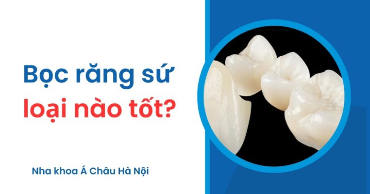 Bọc răng sứ loại nào tốt