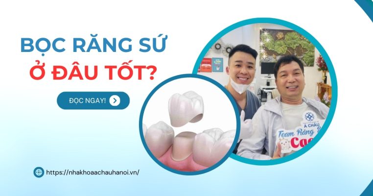 Bọc răng sứ ở đâu tốt?
