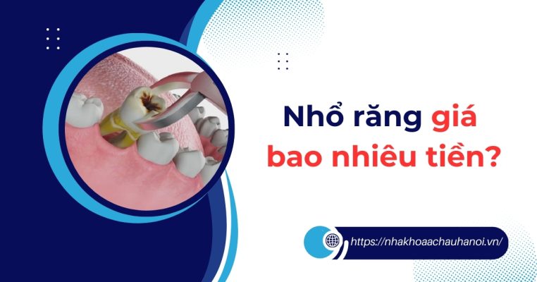 nhổ răng giá bao nhiêu