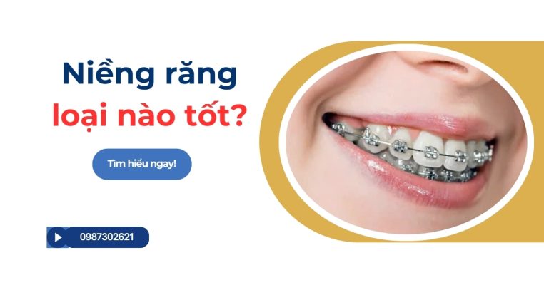 Niềng răng loại nào tốt