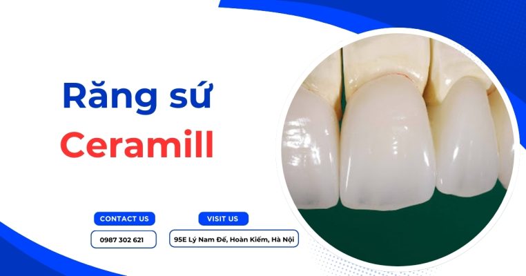 Răng sứ Ceramill