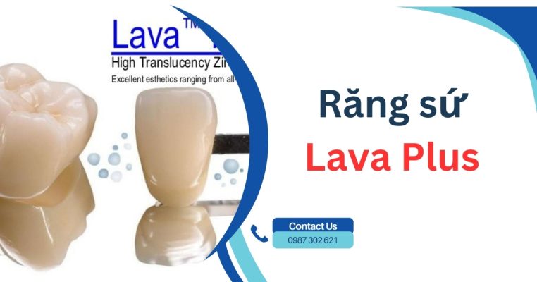 Răng sứ Lavs Plus