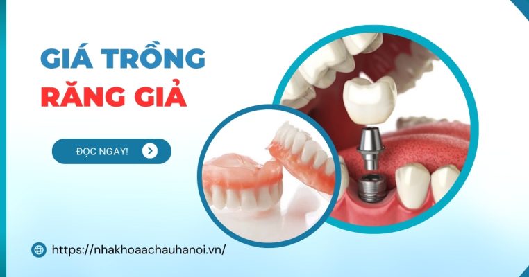 giá trồng răng giả