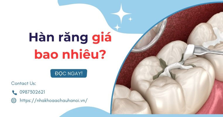 hàn răng giá bao nhiêu
