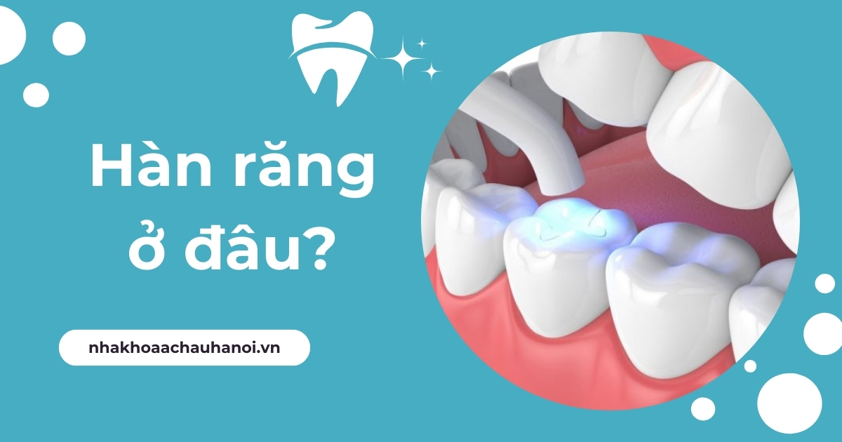 hàn răng ở đâu