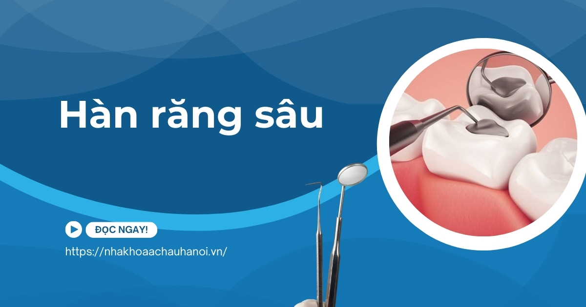 hàn răng sâu