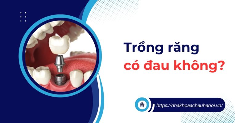 trồng răng có đau không