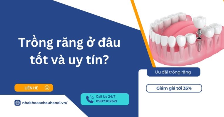 trồng răng ở đâu